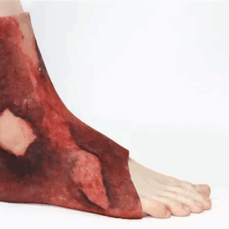 Ankle Sleeve with Burn Wounds – Ayak bileği 3. derece yanık eğitim modeli