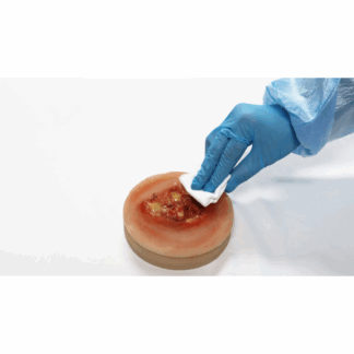 Decubitus Ulcer Stage 3 Task Trainer – Gerçekçi Yara Bakım Modeli