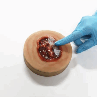 Decubitus Ulcer Stage 4 Task Trainer – 4. evre bası yarası eğitim modeli