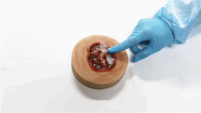 Decubitus Ulcer Stage 4 Task Trainer – 4. evre bası yarası eğitim modeli