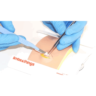 Lipoma Pad ile gerçekçi lipoma eksizyon eğitimi