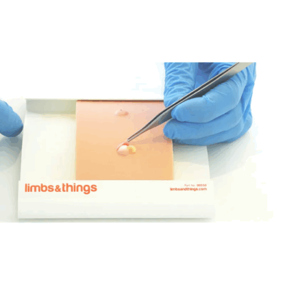 Sebaceous Cyst Pad ile gerçekçi kist eksizyon eğitimi