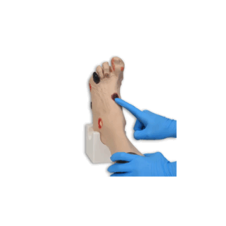 Wilma Wound Foot, 20 farklı yara koşuluyla yara bakımı ve pansuman eğitimi için gerçekçi bir simülatör.